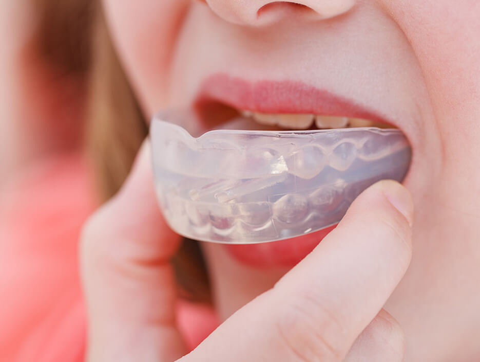 Mouthguards