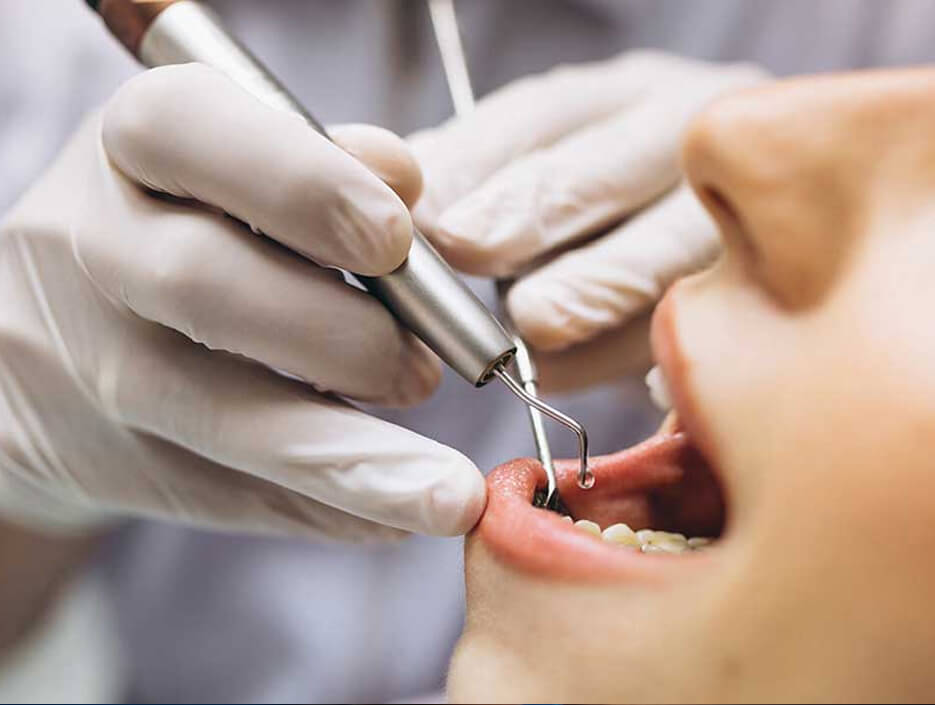 Root Canal Treatments Keysborough